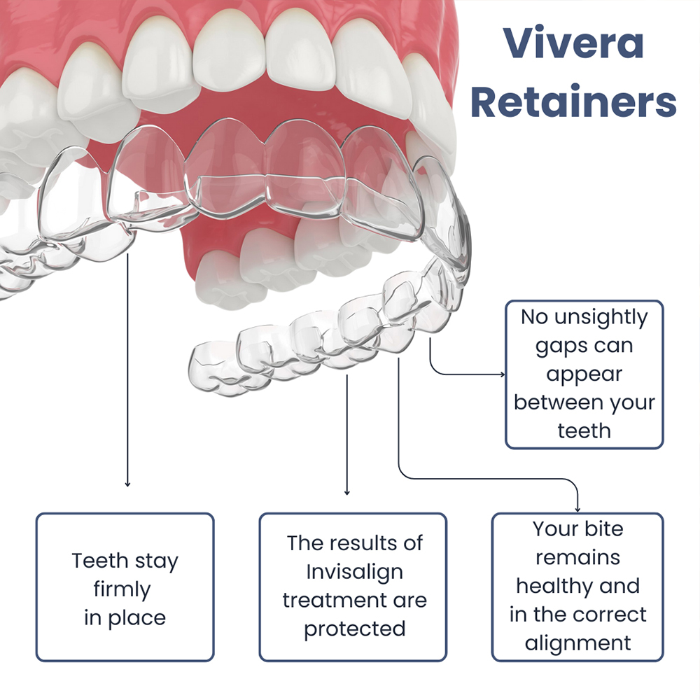 Vivera Retainers